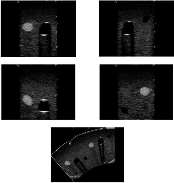 Ultrasound images of universal NAV training phantom
